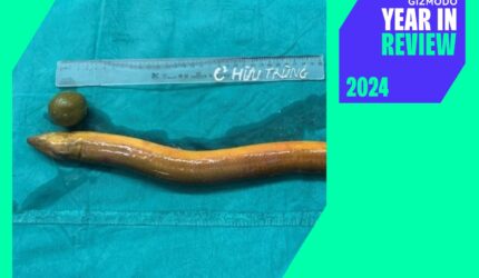 Weirdest Medical Cases 2024