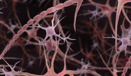 Sel -sel kekebalan otak mikroglia