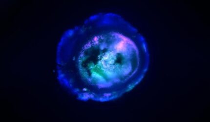 Multi Region Brain Organoid (MRBO)