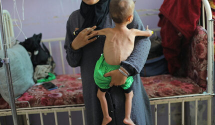 UNICEF: 112 Anak Gazan yang didiagnosis dengan kekurangan gizi akut setiap hari