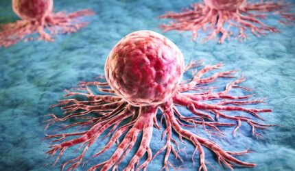 Ilmuwan Menemukan Bagaimana Sel Leukemia “Menipu Kematian” dan Menghindari Pengobatan 3 Sel Kanker Merah Raksasa