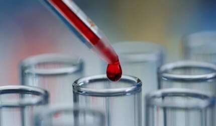 Tabung Tes Cairan Merah Darah Lab Sains