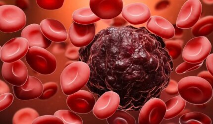 Sel Kanker Di Tengah Sel Darah Merah