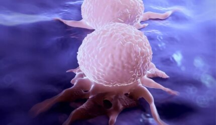 Ilustrasi Pembagian Sel Kanker Payudara