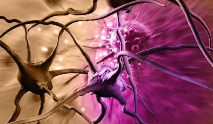 Neuron Sel Kanker Otak