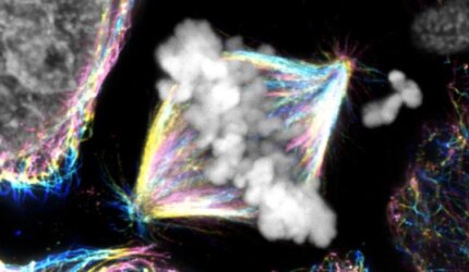 Spindel Metafase dalam Sel Kanker Ovarium Manusia