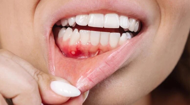 foto slider headline