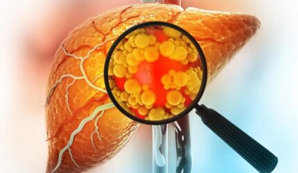 Kaca Pembesar Menampilkan Penyakit Hati