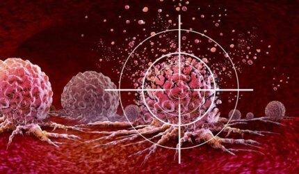 Target Pengobatan Kanker USG