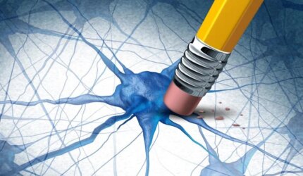 Konsep Penyakit Otak Demensia Alzheimer