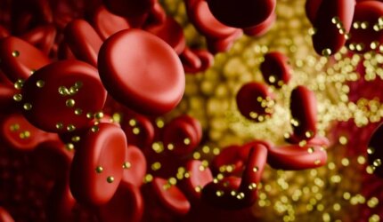 Plak Kolesterol Sel Darah