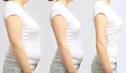 Konsep Penurunan Berat Badan Obesitas