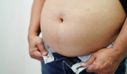 Obesitas Wanita Perut Gemuk