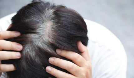 Rambut Beruban Prematur