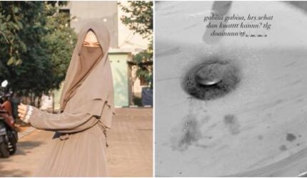 Nahas, Wardatina Mawa Muntah Darah usai Insanul Fahmi Diduga Selingkuh dengan Inara Rusli