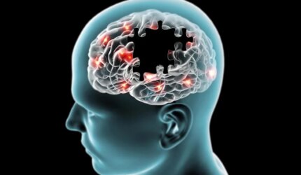 Potongan Puzzle Otak yang Hilang Penyakit Degeneratif Alzheimer Parkinson