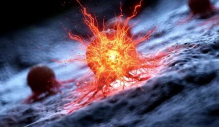 Meledaknya Sel Kanker