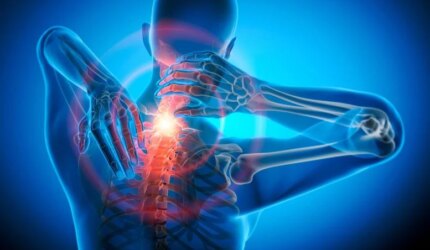 Vertebra Tulang Belakang Leher Nyeri Intens