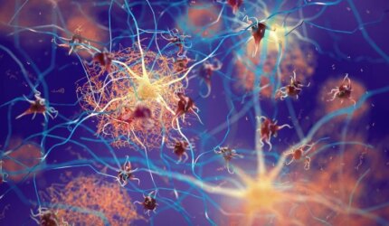 Plak Amiloid Neuron Demensia Alzheimer