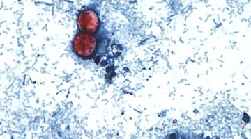 Wabah siklosporiasis besar-besaran terkait dengan empat negara bagian lainnya